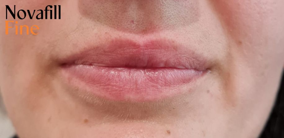 Before image 6
